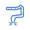 Anal Fissure Treatment